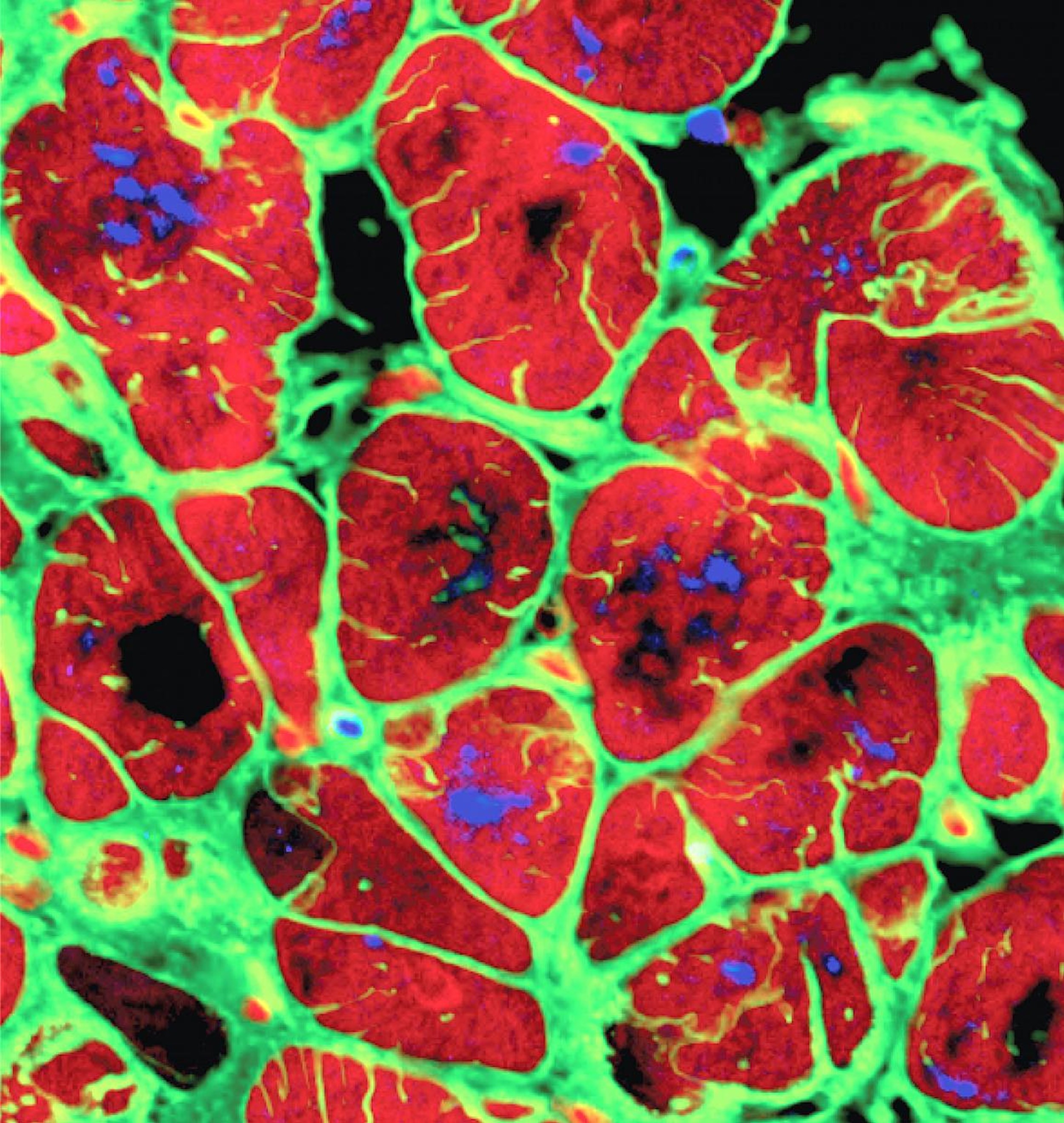 MERLN to start a stem cell growth plant
